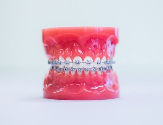 Bayside Braces