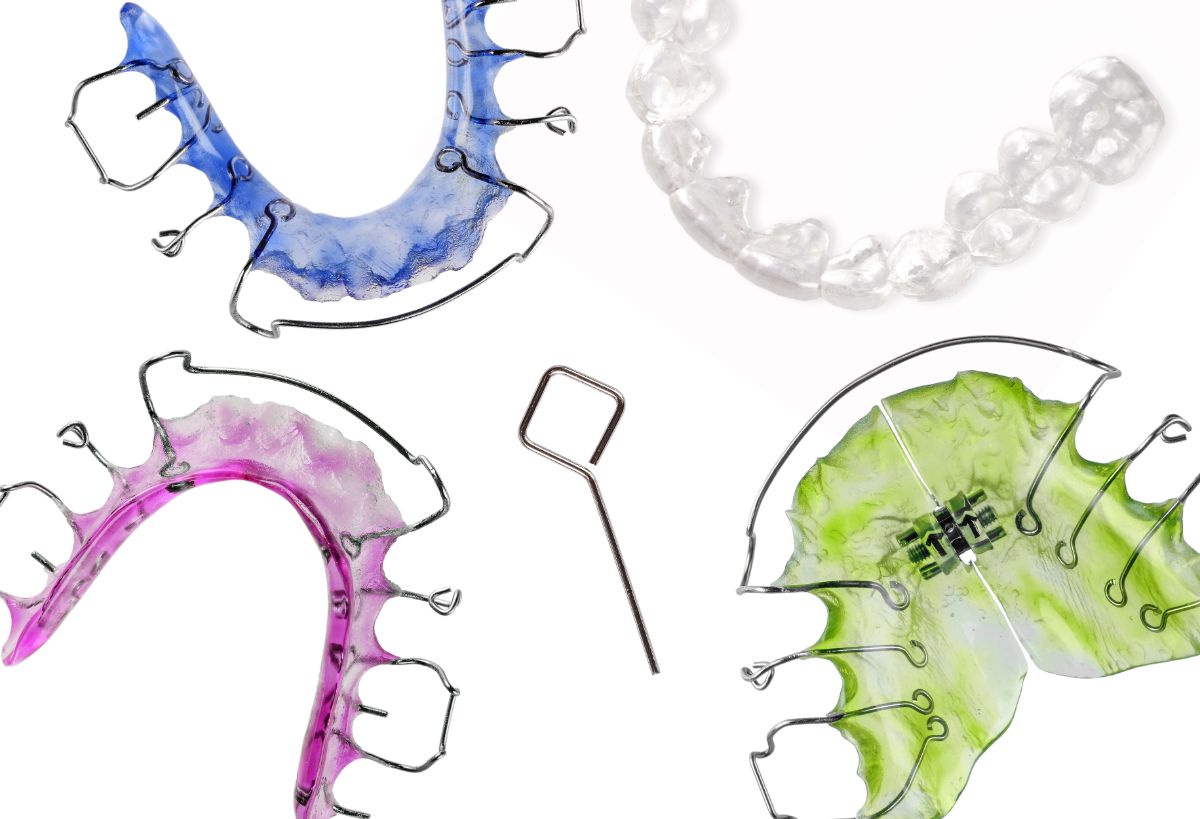 Everything You Need To Know About Retainers