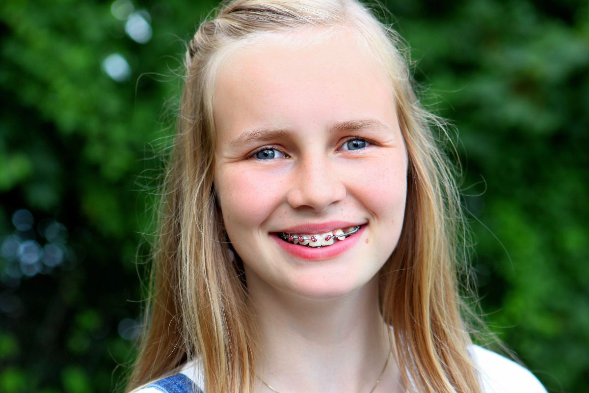 Busting the Top 10 Braces Myths